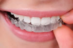 Invisalign® Invisalign®