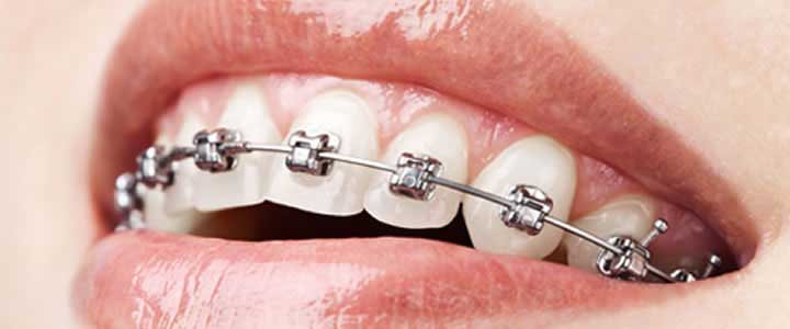 Orthodontic Center @ BIDC Orthodontic Center @ BIDC